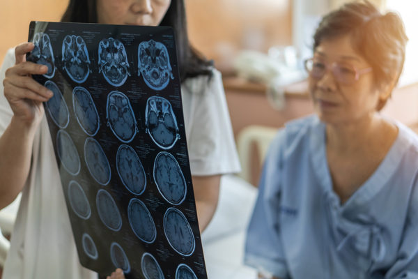 traumatic brain injury on an ageing patient